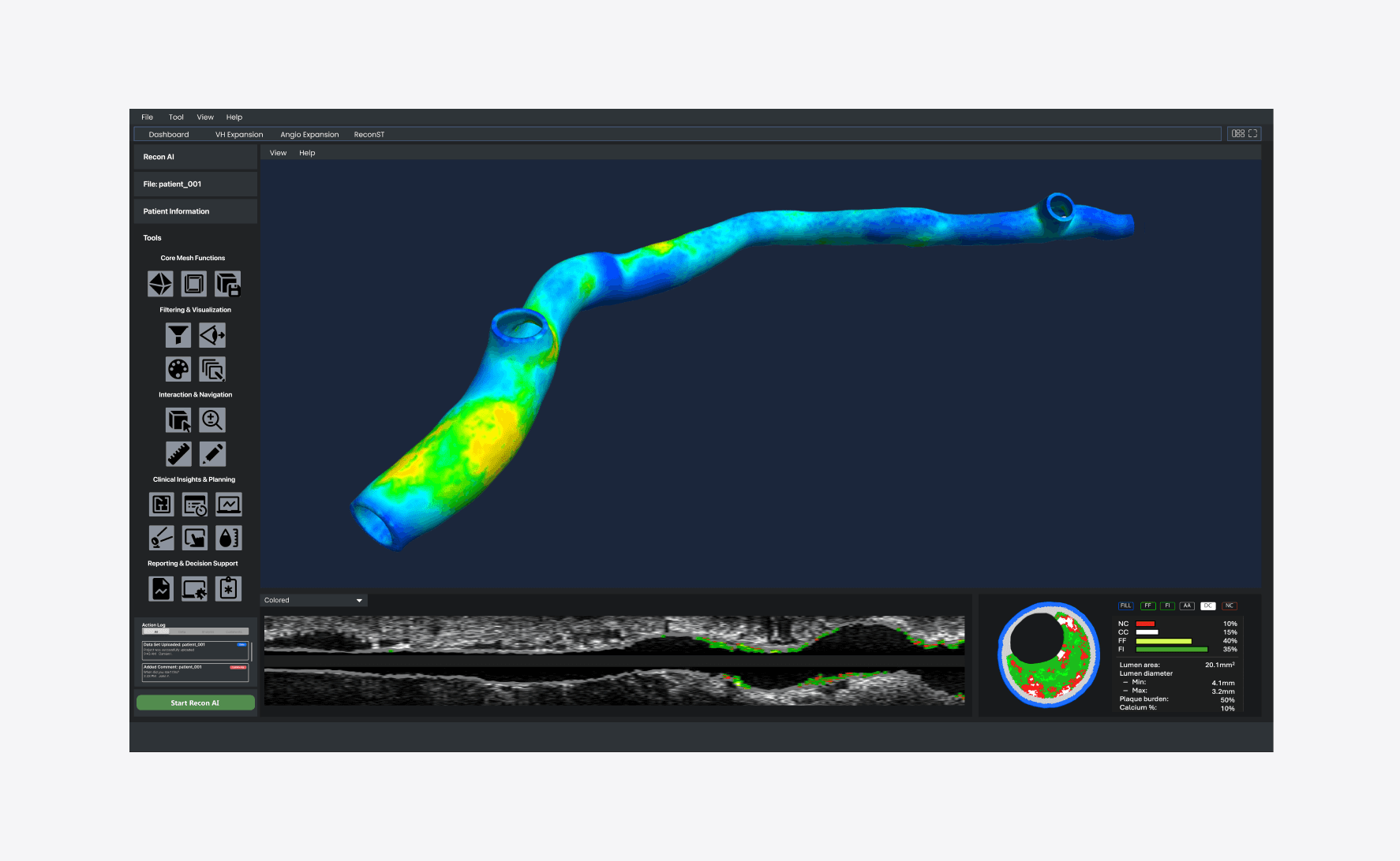 Sancorda Medical - Interactive medical planning platform