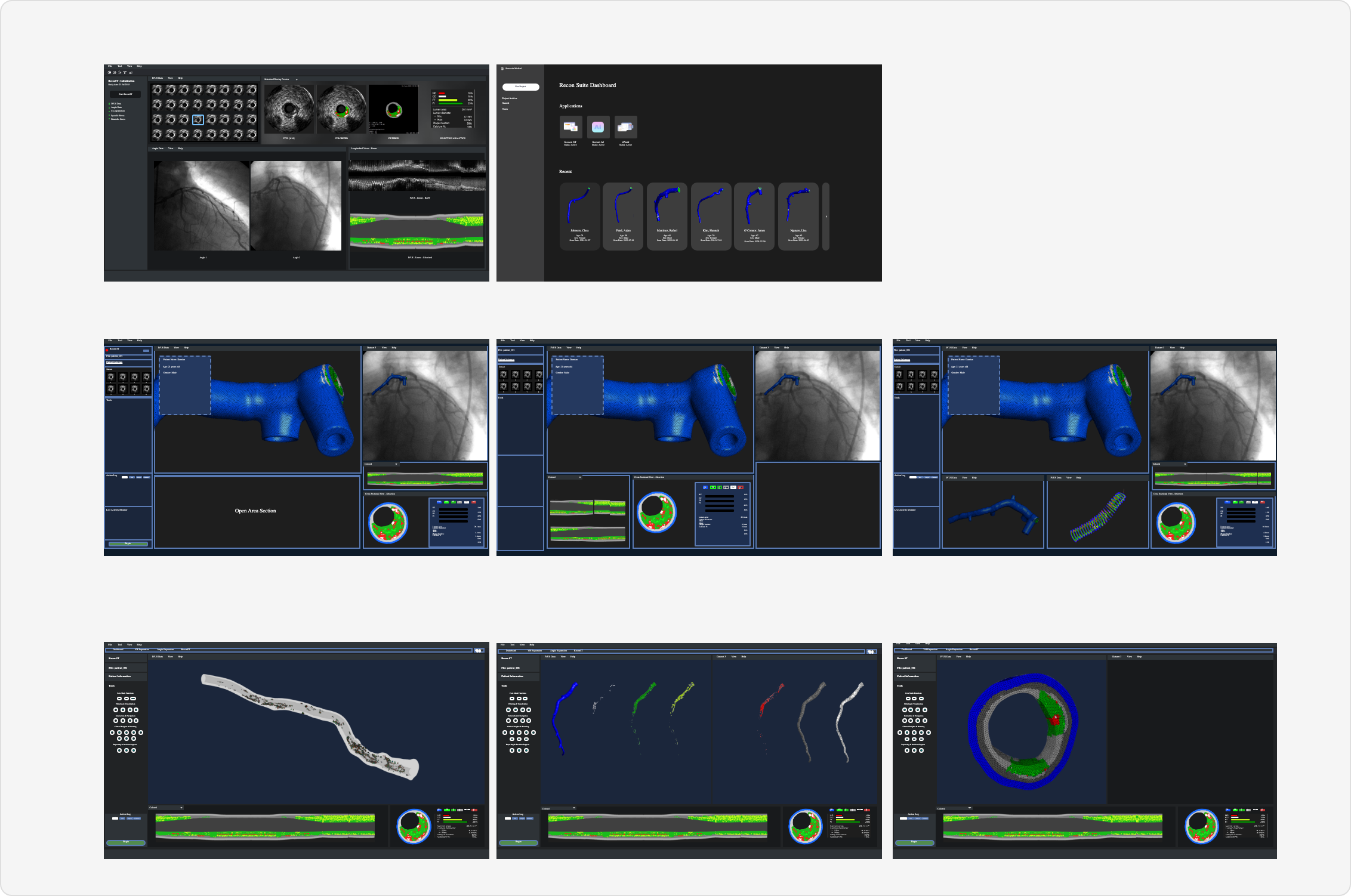 Layout explorations for the Sancorda dashboard